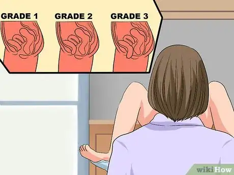 Imagen titulada Diagnose and Treat a Prolapsed Bladder Step 15