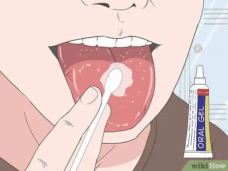 Imagen titulada Heal Your Tongue After Eating Sour Candy Step 3