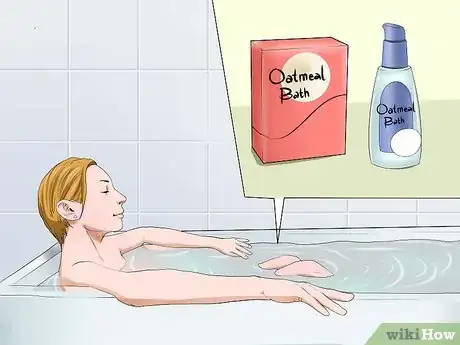 Imagen titulada Get Rid of a Rash Between Your Legs Step 11
