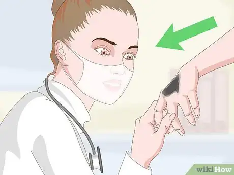 Imagen titulada Remove Tar From Skin Step 16
