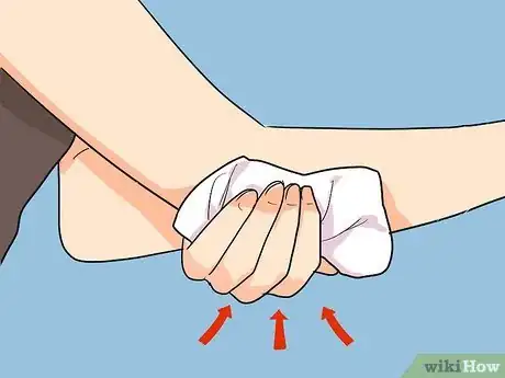 Imagen titulada Treat a Cyst Step 10