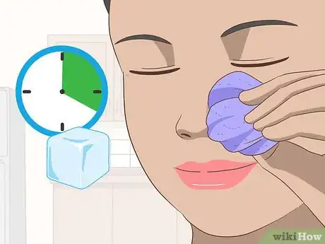 Imagen titulada Treat a Broken Nose Step 5