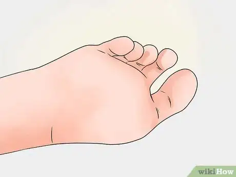 Imagen titulada Care for a Burst Blister Step 11