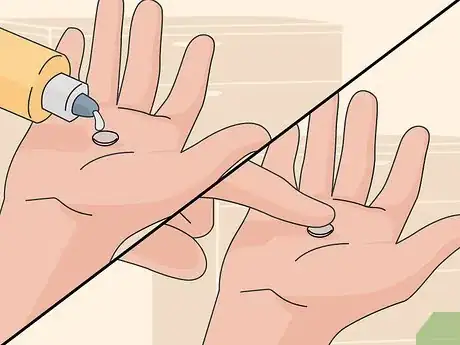 Imagen titulada Deal With Uncomfortable Contact Lenses Step 9