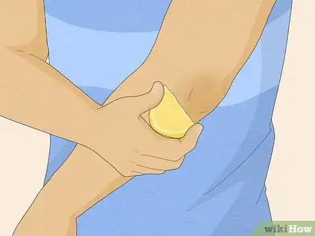 Imagen titulada Clean Your Elbows Step 6