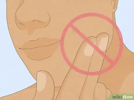 Imagen titulada Treat a Face Rash After Waxing Step 19