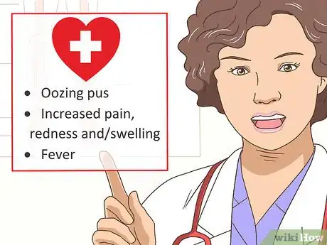 Imagen titulada Treat a Blistering Burn on Your Finger Step 14