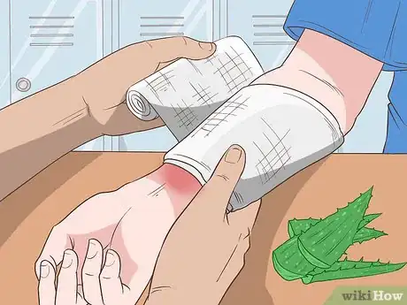 Imagen titulada Use Aloe Vera Step 4