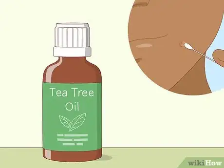 Imagen titulada Avoid Blind Pimples Step 9