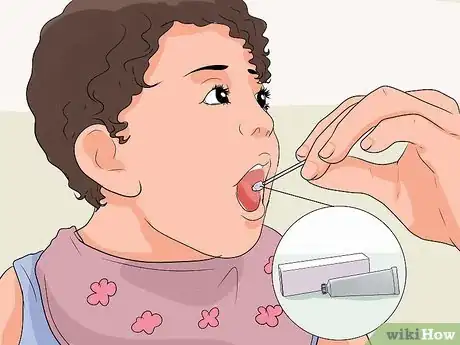 Imagen titulada Treat Thrush Step 6