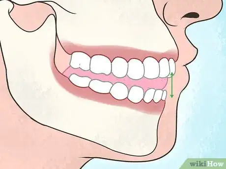 Imagen titulada Relax Your Facial Muscles Step 2