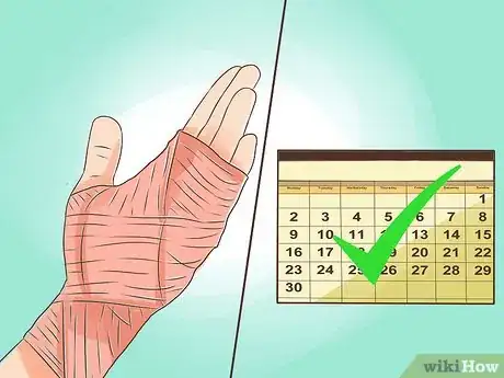 Imagen titulada Treat a Burn Using Honey Step 18