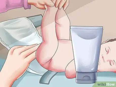 Imagen titulada Identify and Change a Soiled Diaper Step 6