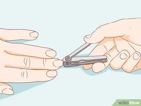 Imagen titulada Deal with Nipple Eczema Step 5