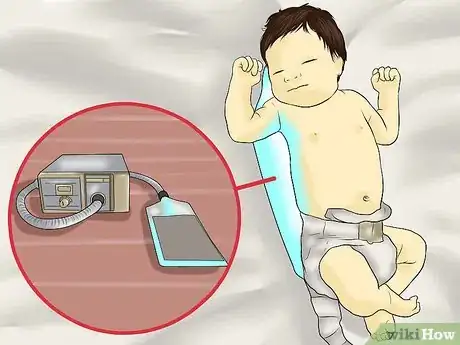 Imagen titulada Lower Bilirubin Step 4