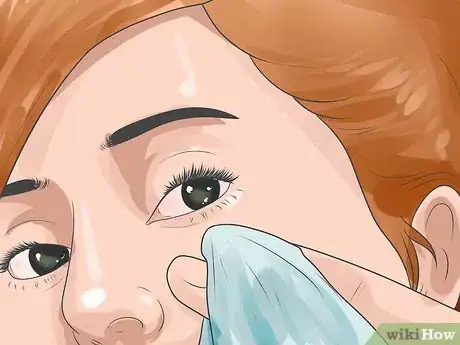 Imagen titulada Recover from Eye Surgery Step 16