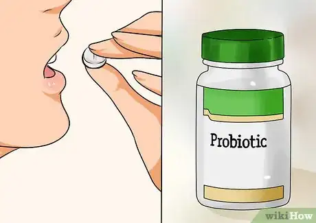 Imagen titulada Treat Vaginitis Step 5