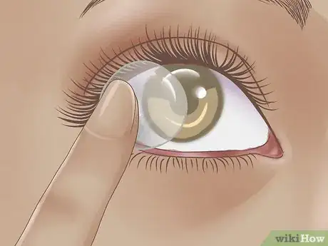 Imagen titulada Care for Contact Lenses Step 3