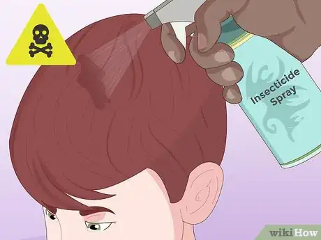 Imagen titulada Prevent Lice Step 5