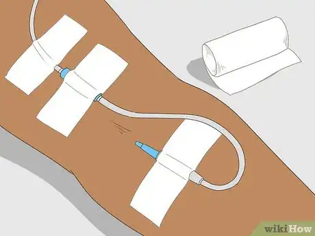 Imagen titulada Insert an IV Step 17