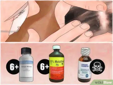 Imagen titulada Treat Head Lice with Vinegar Step 6