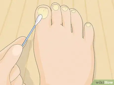 Imagen titulada Use Tea Tree Oil Step 9