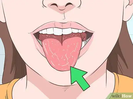 Imagen titulada Suppress the Gag Reflex Step 4