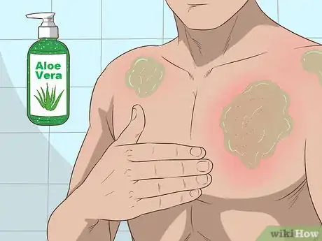 Imagen titulada Use Aloe Vera Step 2