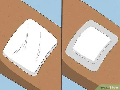 Imagen titulada Stop Scratching Irritated Skin Step 6