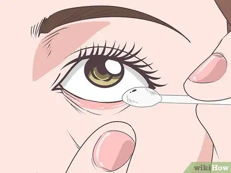 Imagen titulada Get Stuff out of Your Eye Step 12
