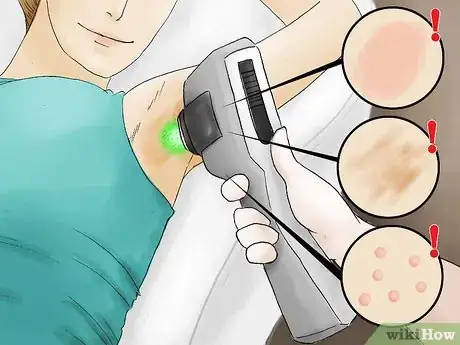 Imagen titulada Keep a Woman's Underarms Hairfree Step 22