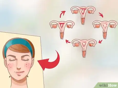 Imagen titulada Balance Hormones for Acne Step 7