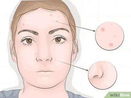 Imagen titulada Use Cleansing Foam Step 6