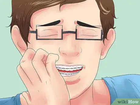 Imagen titulada Alleviate Orthodontic Brace Pain Step 16