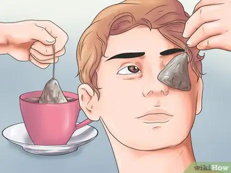 Imagen titulada Get Rid of Bags Under Your Eyes Step 4