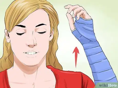 Imagen titulada Manage a Broken Arm Step 12