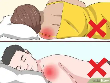 Imagen titulada Sleep with Rotator Cuff Pain Step 4