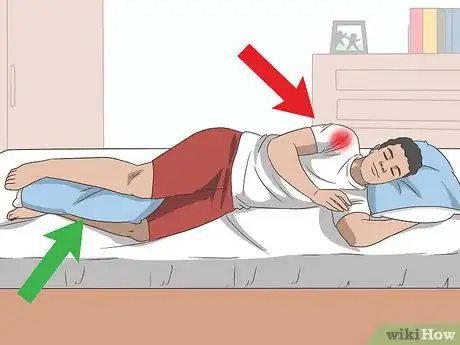 Imagen titulada Sleep with Rotator Cuff Pain Step 2
