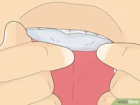 Imagen titulada Make a Fake Retainer Out of Wax Step 8