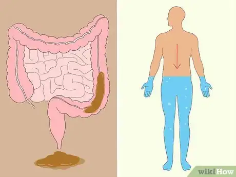 Imagen titulada Know If You Have Worms Step 23