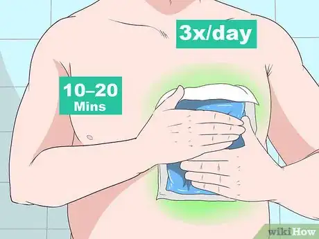 Imagen titulada Treat Broken Ribs Step 4