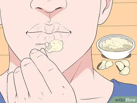 Imagen titulada Treat a Cold Sore or Fever Blisters Step 21