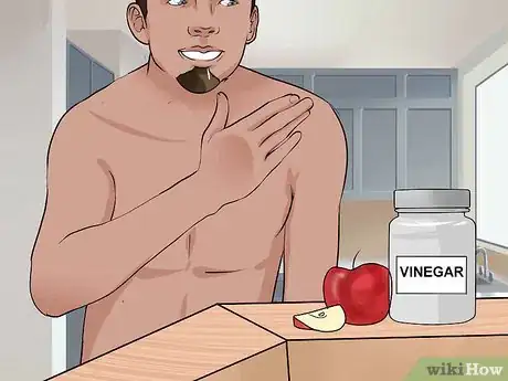 Imagen titulada Identify and Treat Ringworm Step 10