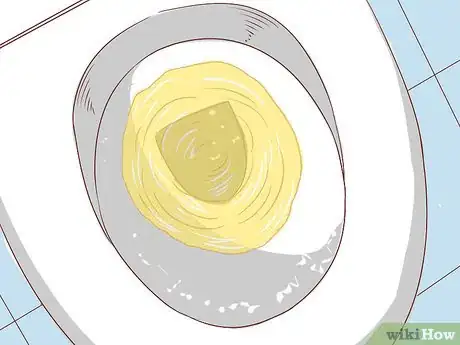 Imagen titulada Strengthen Your Bladder and Urinate Less Often Step 8