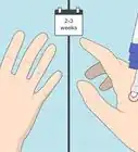 congelar verrugas con nitrógeno líquido