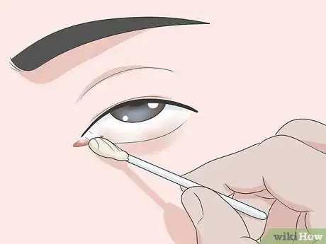 Imagen titulada Get Sand Out of Your Eyes Step 10