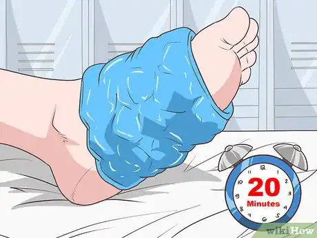 Imagen titulada Cure Metatarsalgia Step 2