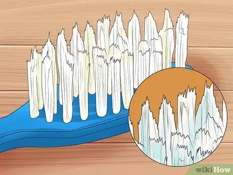 Imagen titulada Alleviate Orthodontic Brace Pain Step 13