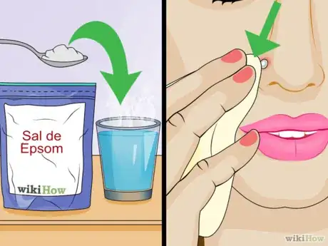Imagen titulada Tell_if_a_Piercing_Is_Infected_Step_13