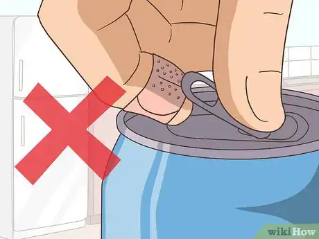 Imagen titulada Treat a Blistering Burn on Your Finger Step 12